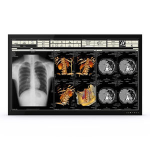 monitor médico