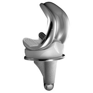 prótesis de rodilla tricompartimental