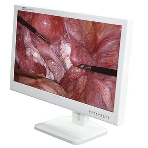 monitor médico 1