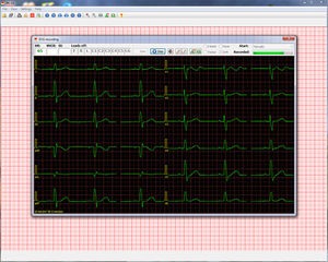 software para ECG