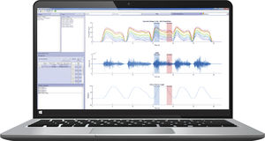 software de análisis 1