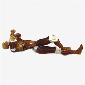 fantoma de prueba para radiología