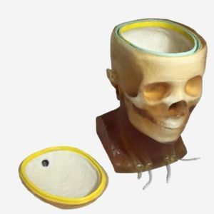 fantoma de prueba para radiología