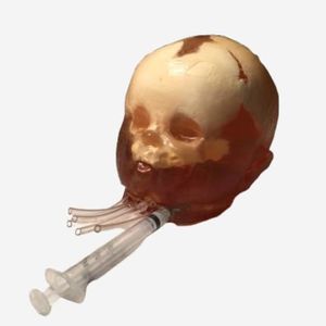 fantoma de prueba para radiología
