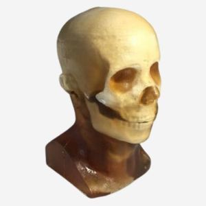 fantoma de prueba para radiología