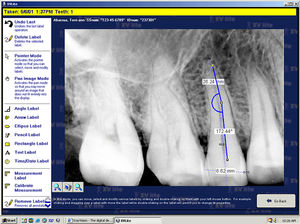 software para imagen dental