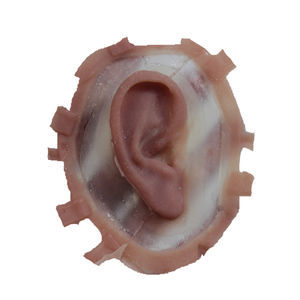 prótesis estética esterna auricular