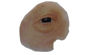 prótesis estética esterna orbital