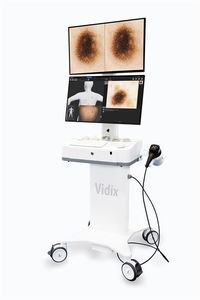 dermatoscopio de vídeo 1
