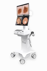 dermatoscopio de vídeo