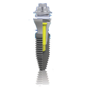 implante dental cilíndrico