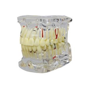 modelo anatómico de dentadura 1