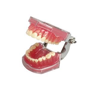 modelo anatómico gingival 1