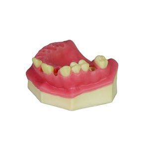 modelo anatómico gingival 1