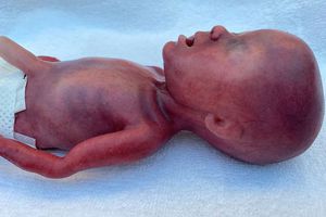 maniquí de prácticas para atención pediátrica