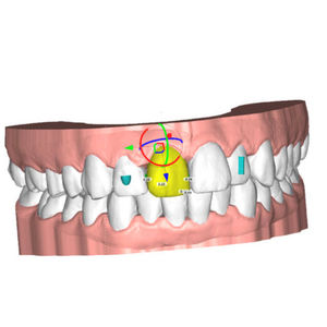 software de laboratorio dental