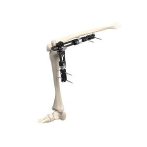 fijador externo de rodilla