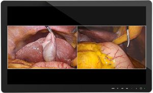 monitor médico