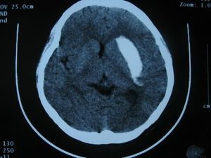 película radiográfica para radiografía polivalente 1