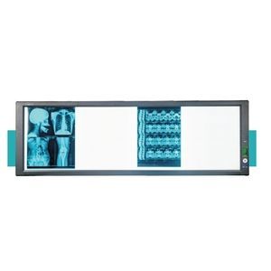 negatoscopio con intensidad luminosa ajustable