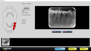 software para imagen dental