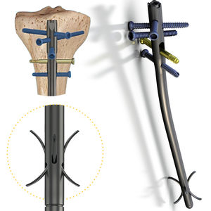 clavo intramedular para tibia