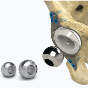prótesis de cabeza femoral 1