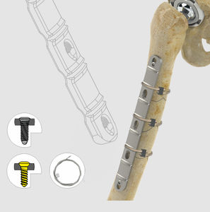 placa de compresión para fragmentos óseos grandes 1