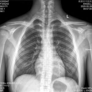 película radiográfica para radiografía polivalente 1