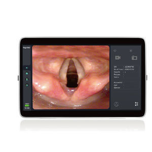 procesador de vídeo para endoscopia