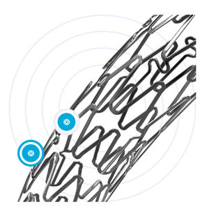stent arteria coronaria