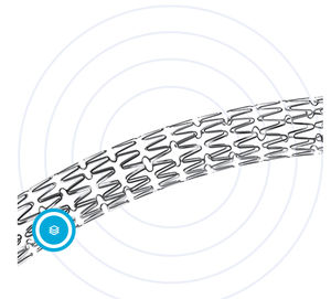 stent arteria coronaria 1
