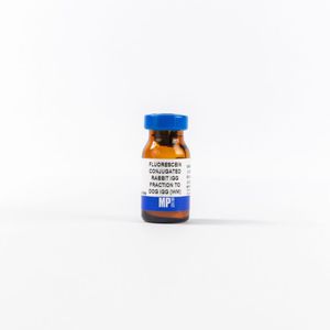 reactivo de proteínas 1