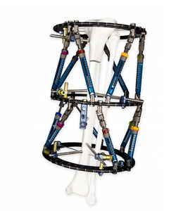 fijador externo para tibia