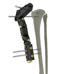 fijador externo para tibia 1