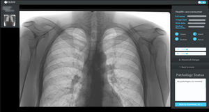 software de radiología