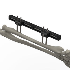 fijador externo para muñeca 1