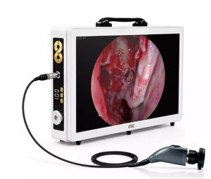 cámara para endoscopio 1