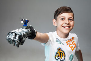prótesis de mano con control motor