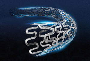 stent arteria coronaria