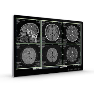 monitor para imágenes médicas