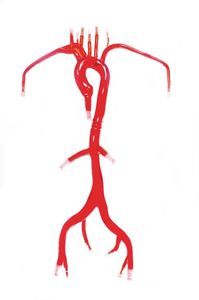 modelo vascular de arteria femoral 1