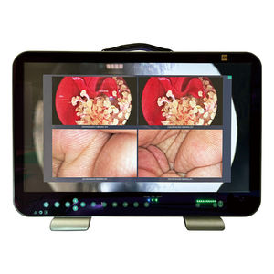 cámara de vídeo para endoscopio