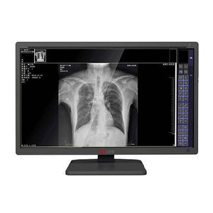 monitor médico 1