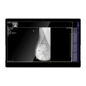 monitor médico 1