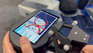 sistema de neuronavegación por EMT
