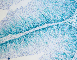 kit de reactivos colorante 1