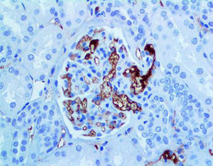 reactivo anticuerpo monoclonal 1