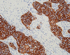 reactivo anticuerpo monoclonal