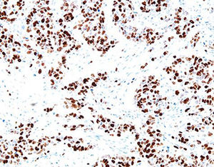 reactivo anticuerpo monoclonal 1
